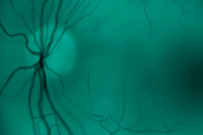 Medical scan of a retina showing blood vessels