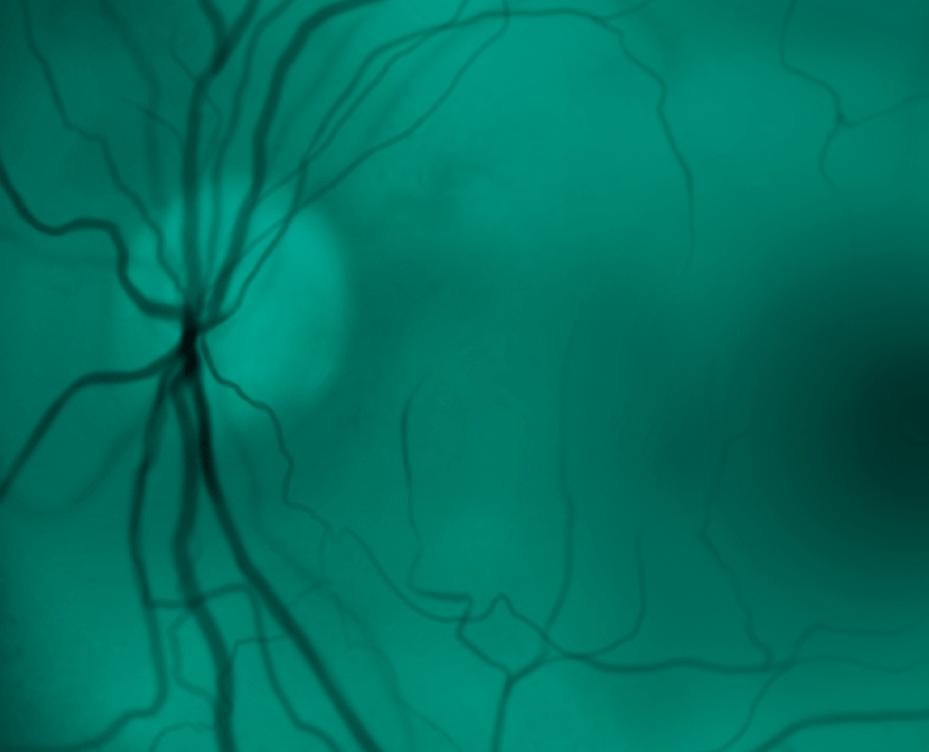 Medical scan of a retina showing blood vessels