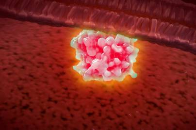 3D depiction of KRAS protein complex