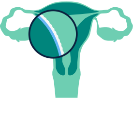 illustration of a uterus
