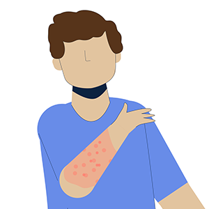 Illustration of small boy with red spots on his arm