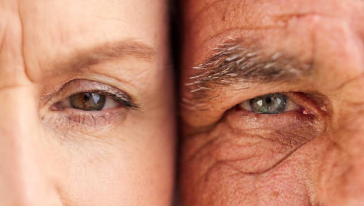 Close-up of two eyes side by side, showing contrast in skin tone and eye color between two individuals.