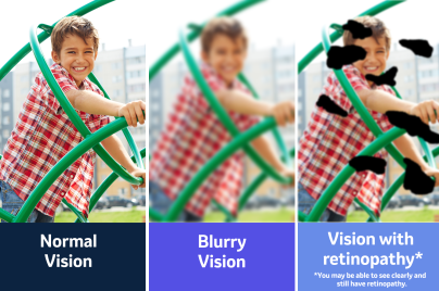 health literacy retinopathy