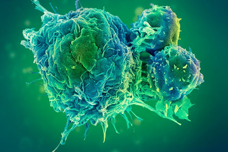 Science visuals cancer cell and T-lymphocytes
